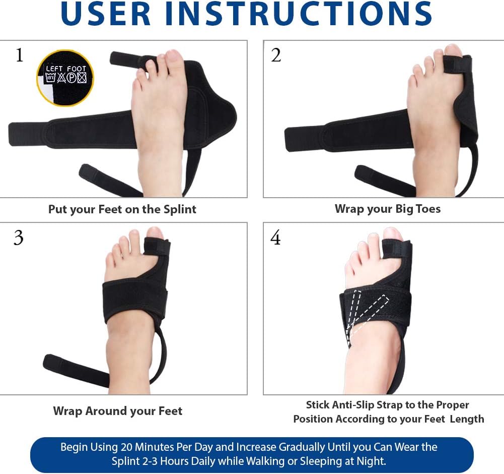 Caretras Bunion Corrector, Orthopedic Bunion Splint, Big Toe Separator Pain Relief, Non-Surgical Hallux Valgus Correction, Hammer Toe Straightener, Day Night Support: Health & Personal Care