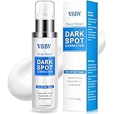 Dark Spot Remover for Face and Body, Dark Spot Corrector, Age Spot Sun Spot Freckles Dark Spot Remover, Melasma Treatment for Face, Advanced Skin Care Cream for Women and Men (1.7 Fl Oz)