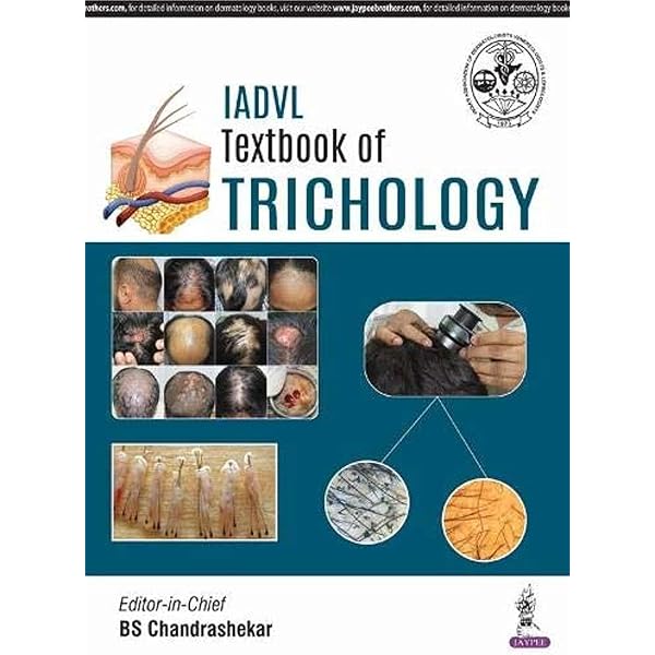 Atlas of Trichoscopy: Dermoscopy in Hair and Scalp Disease