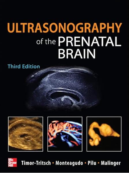 Ultrasonography Of The Prenatal Brain Third Edition 9780071613064 Medicine Health Science Books Amazon Com Ultrasonography Of The Prenatal Brain Third Edition 9780071613064 Medicine Health Science Books Amazon Com