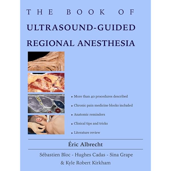 Amazon.com: Hadzic's Textbook of Regional Anesthesia and Acute