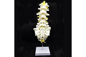 XINDAM Medical Human Lumbar Spine Demonstration Model Anatomical Model Lumbar Vertebrae Sacrum & Coccyx, with Herniation Disc,for Science Classroom Study Display Teaching Medical Model 15 Inch Hight