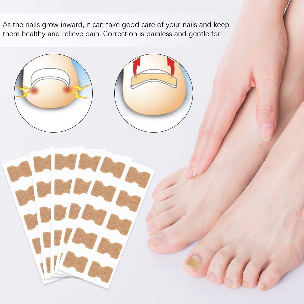 DKAF 5 Sheets Glue Free Toenail Patch with 1 Pcs Nail Hook, Ingrown Toenail Removal Correction Patch Foot Nail Treatment Tool, Toenail Correction Sticker: Beauty
