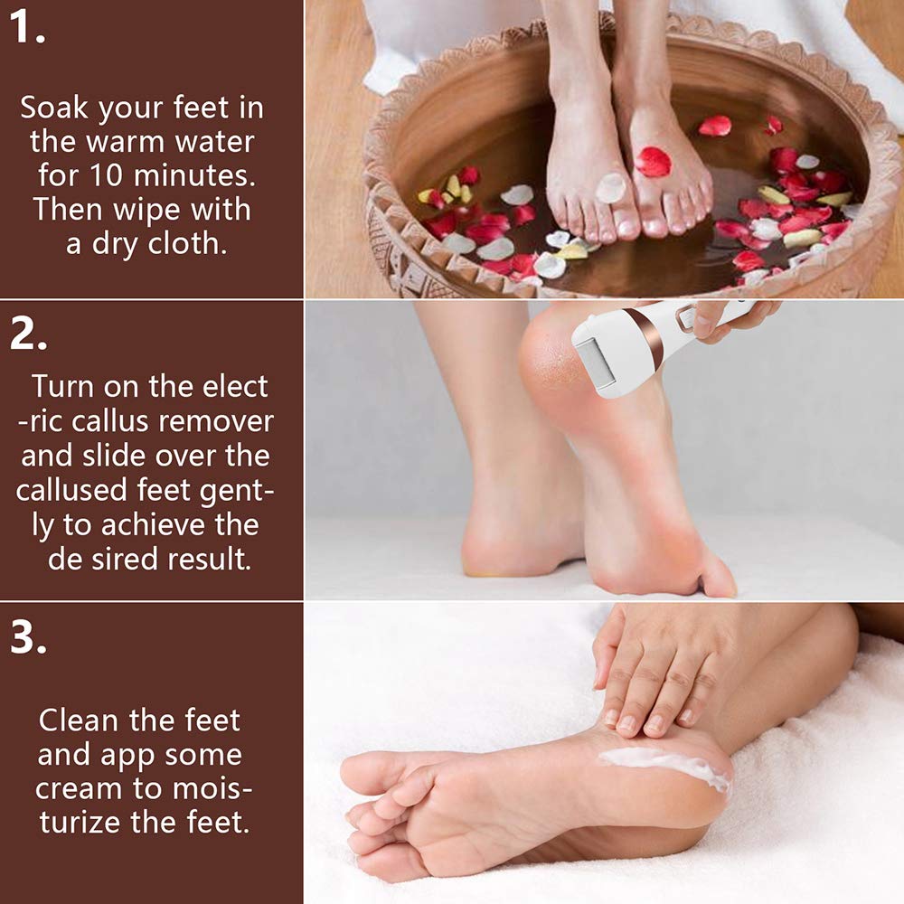 Electric Foot Callus Remover Kit, ELMCHEE Rechargeable callous removers 3 Grinding Heads Portable Waterproof foot file, Professional Feet Care Perfect for Dead, Hard Cracked Dry Skin : Beauty