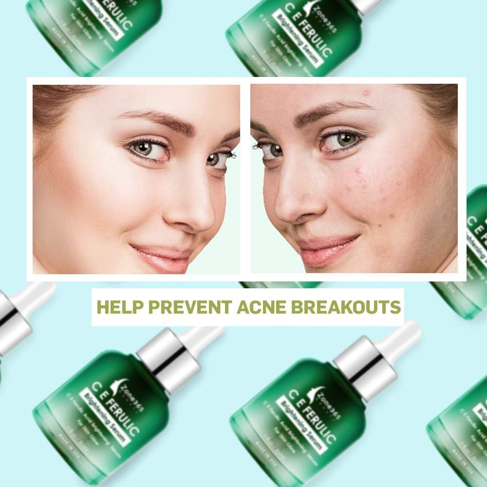ce ferulic acne