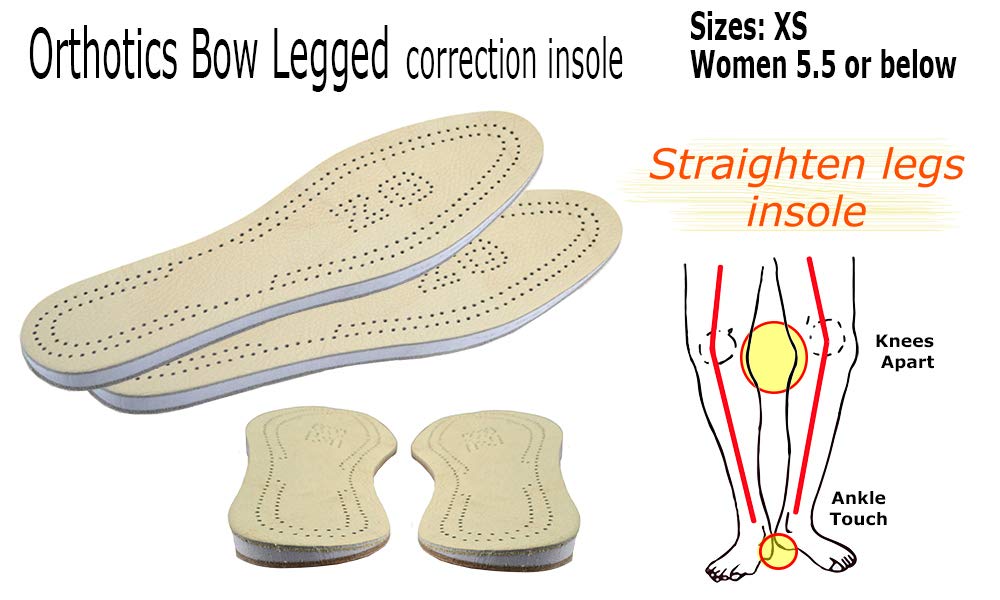 Amazon.com: USFOOT® Orthotics Bow Leg Insole (Genu varum), Bow Leg Corrector, Knock keen Corrector, Genu varum Shoes Insole (1 Pair) (Extra Large) US Size ...
