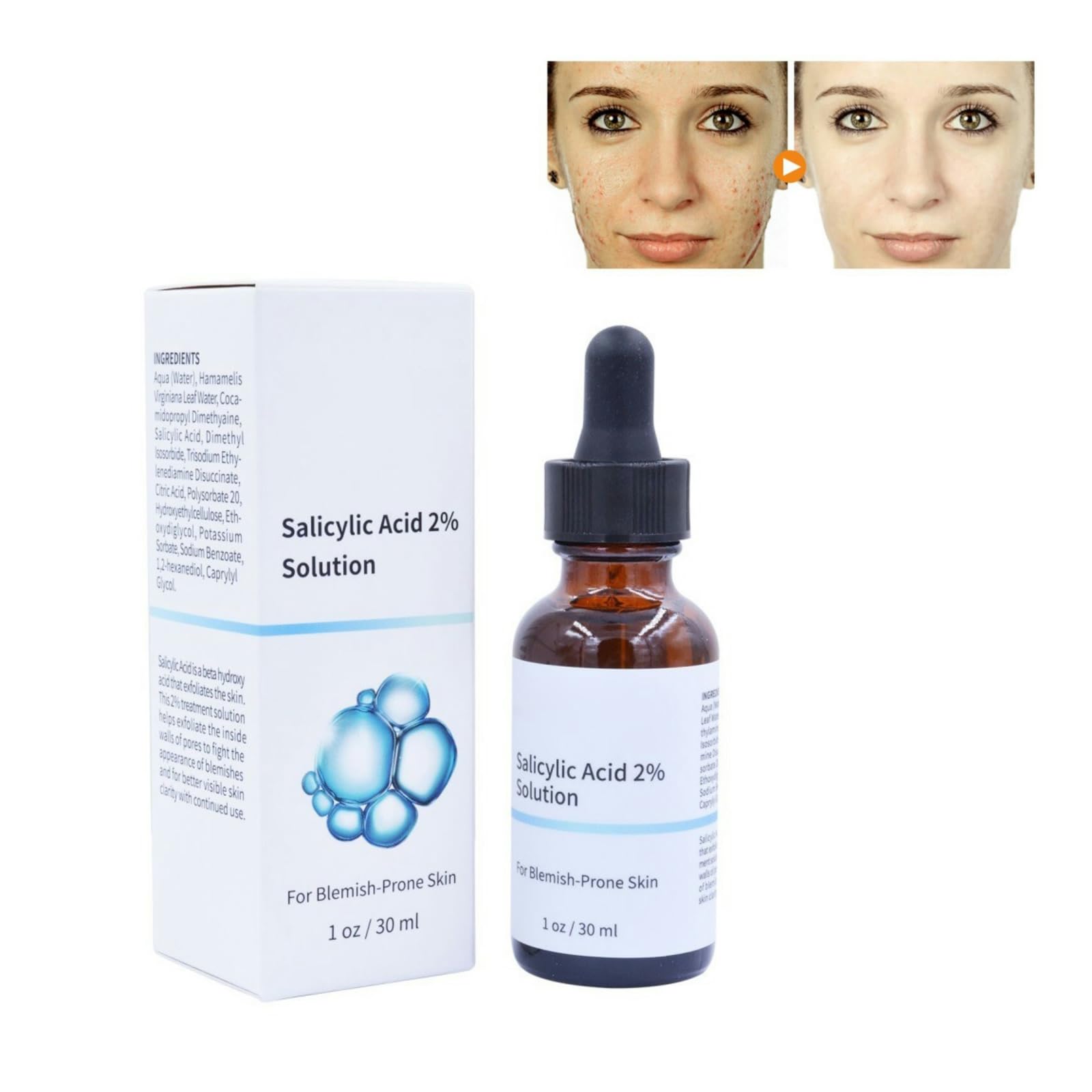 Salicylic Acid Serum 2% Concentrate Super Strong, Lightweight Face Serum for Acne Prone and Oily Skin, Smooth Skin Texture, 30ml