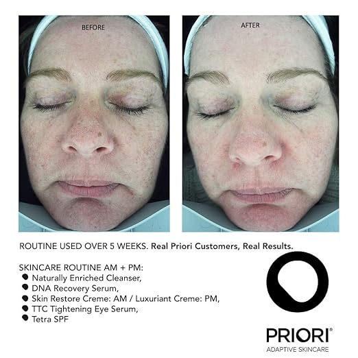 priori eye serum