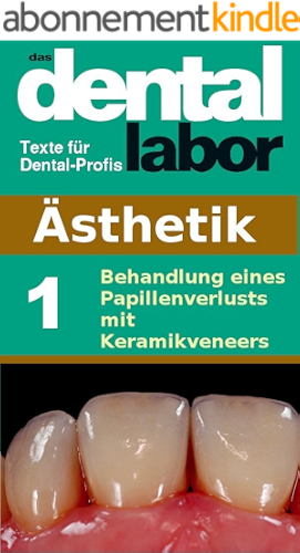 Download Behandlung eines Papillenverlusts mit Keramikveneers (das dental labor Fachtexte 13) (German Edition) PDF