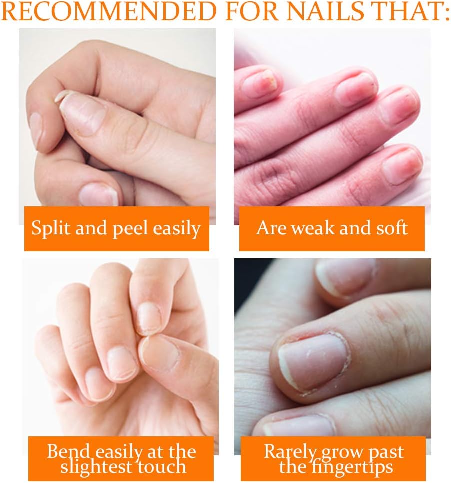 NailTek Nail Recovery Kit, Cuticle Oil, Strengthener, Ridge Filler - restore damaged nails in 3 steps: Beauty