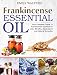 Frankincense Essential Oil: Your Complete Guide To Frankincense Essential Oil Uses, Benefits, Applications And Natural Remedies
