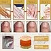 Ochine 30ML Fungal Treatment Essence Onychomycosis Fungal Remover Nail Feet Care Serum