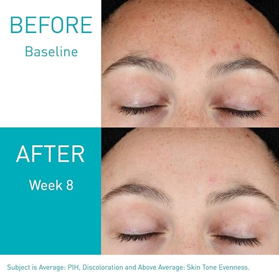 retinol cerave serum