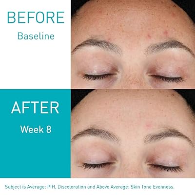 resurfacing face serum