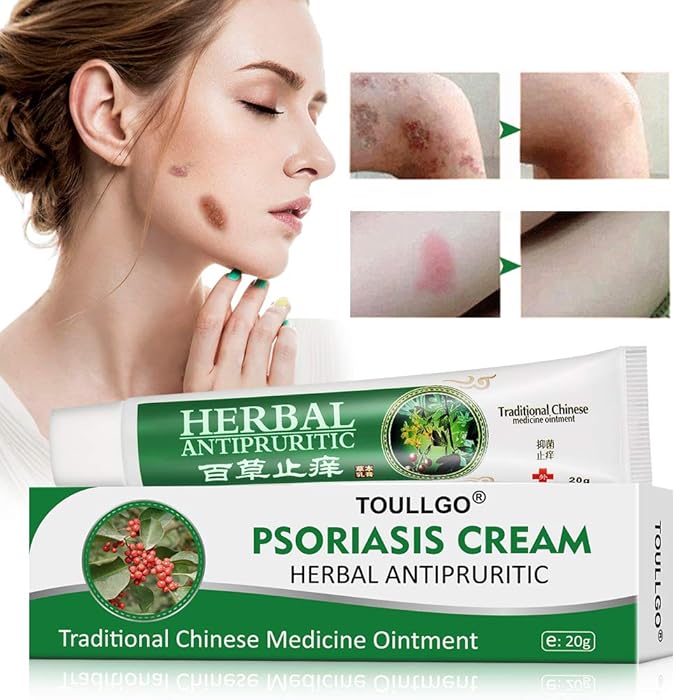 Buy Psoriasis Cream, Psoriasis Treatment, Seborrheic Dermatitis Cream, Chinese Herbal Ointment