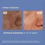 ISDIN Nutradeica Facial Gel Cream 50ml for Seborrheic Skin Hydrates Soothes view 4