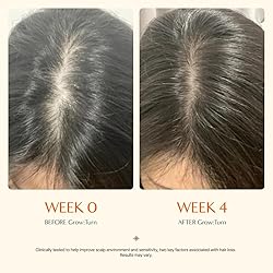 Growturn Hair serum with Built in Brush for Hair