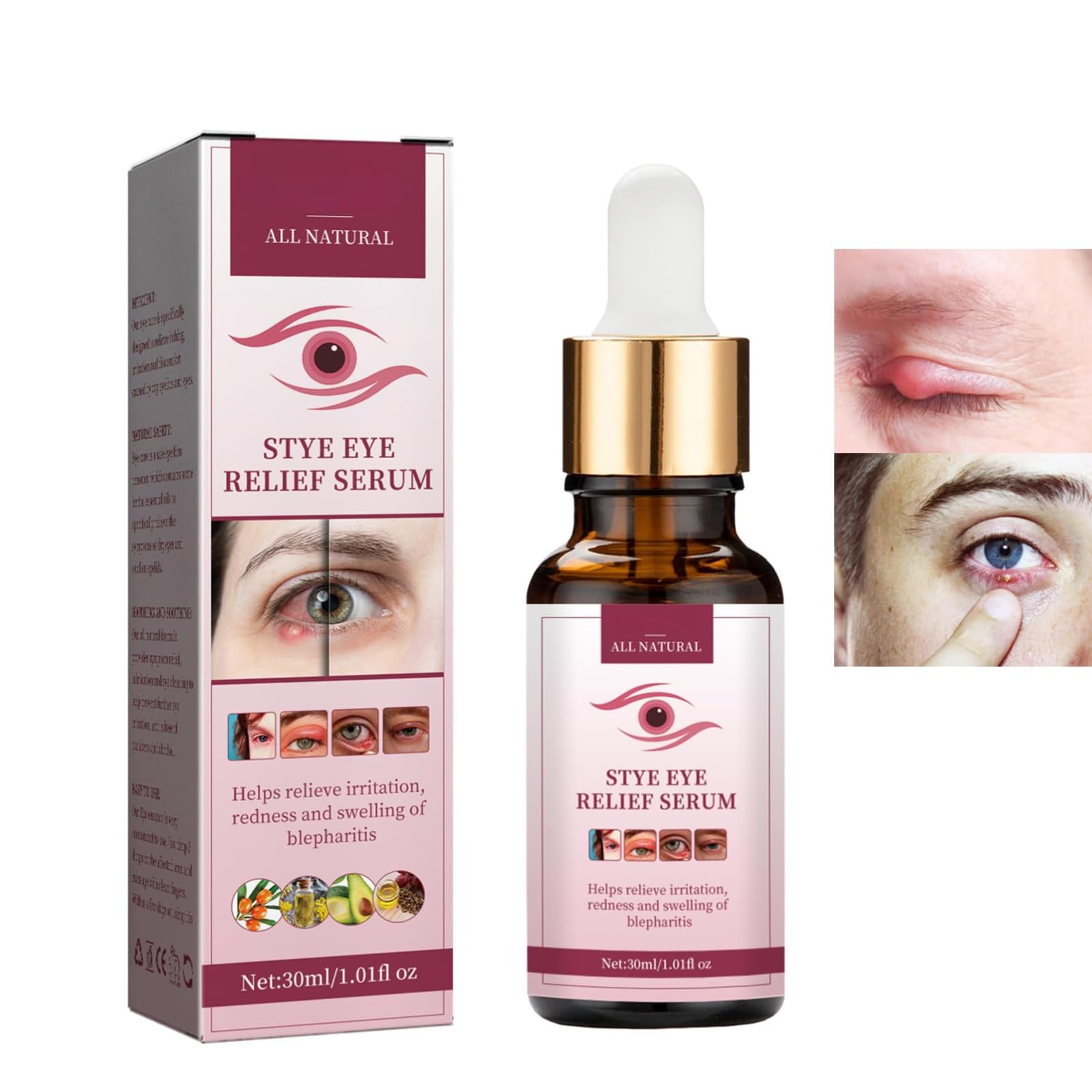 Stye EyeTreatment,MyceliaBlepharitis,RelievePuffinessSerum,Eye Drops for Infected Eyes for StyesChalazion&Blepharitis,Daily Cleanser For Dry Eye Relief 30ml