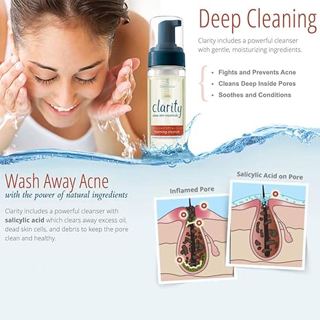 clarity acne