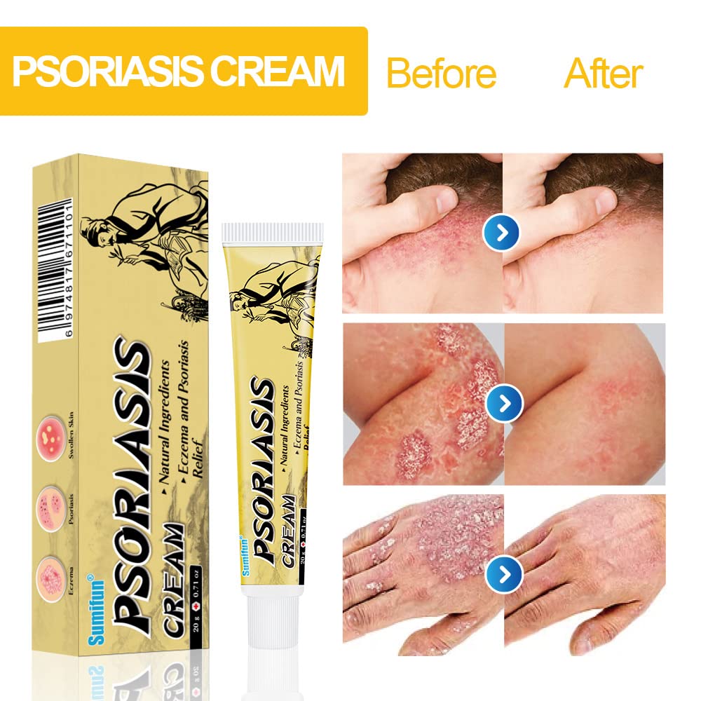 Sumifun Psoriasis Cream, Moisturizing Eczema Cream, Natural Anti-Itch Cream for Dermatitis, Acne, 0.71 oz, Pack of 5