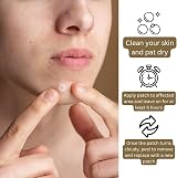 Derma V10 Spot Zapper Patches 24 Hydrocolloid Blemish Pimples Waterproof view 3