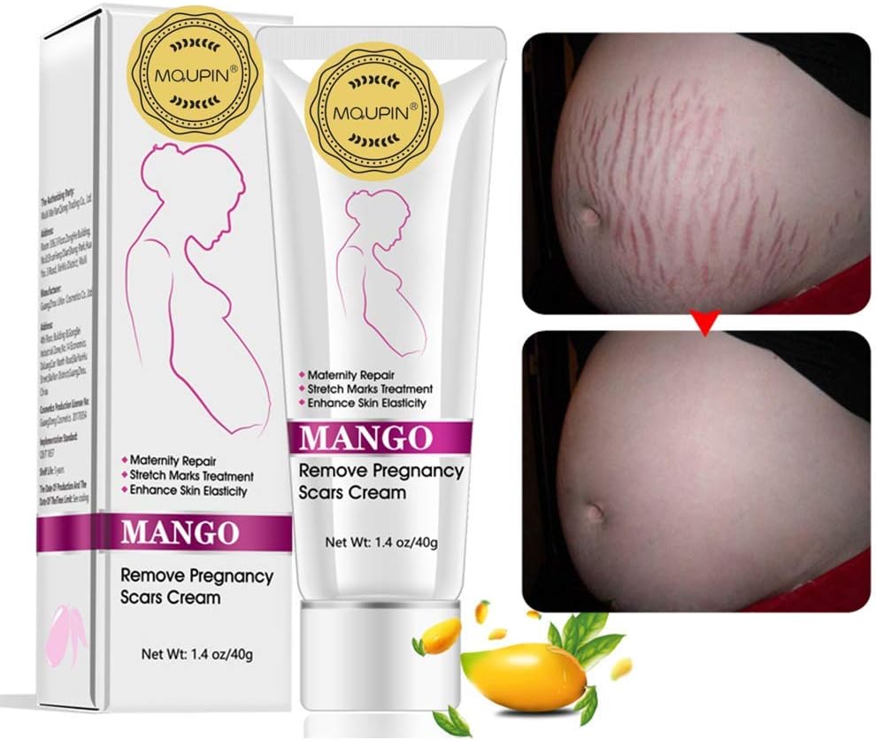 beaufix stretch mark cream