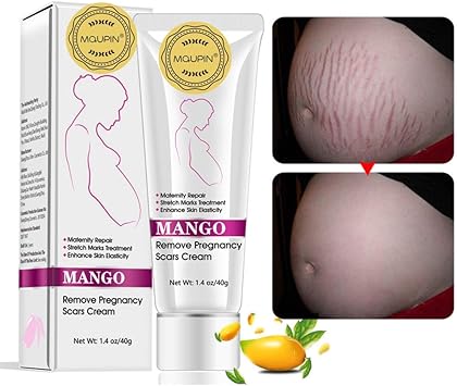 best cream for stretch marks canada