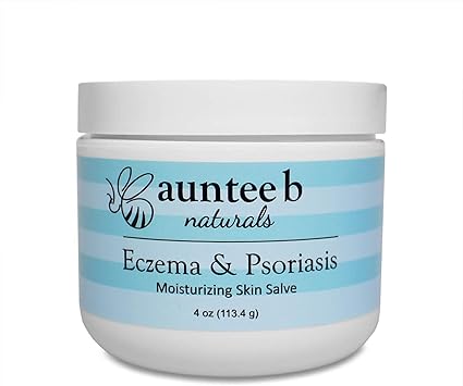 vitamin a cream for eczema