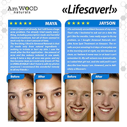 Acne Spot Treatment Cream - Made in USA - Fast-Acting Formula for Clearing Severe Acne from Face & Body - Effective & Invisible Cystic Acne Cleanser Solution for Teens & Adults