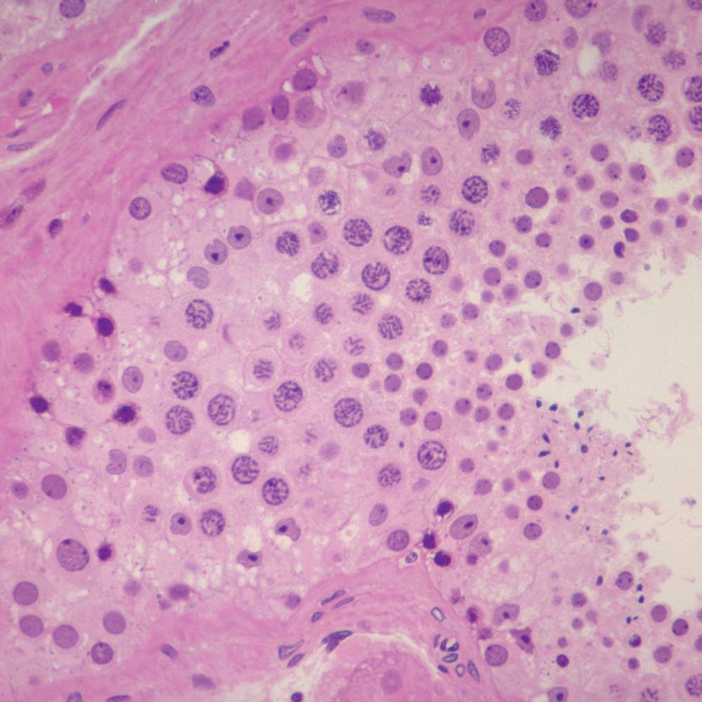 Amazon Com Human Testis Sec 7 M H E Microscope Slide Industrial Scientific Amazon Com Human Testis Sec 7 M H E Microscope Slide Industrial Scientific