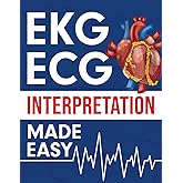 EKG | ECG Interpretation Made Easy: An Illustrated Study Guide For Students To Easily Learn How To Read & Interpret ECG Strips