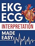 EKG | ECG Interpretation Made Easy: An Illustrated