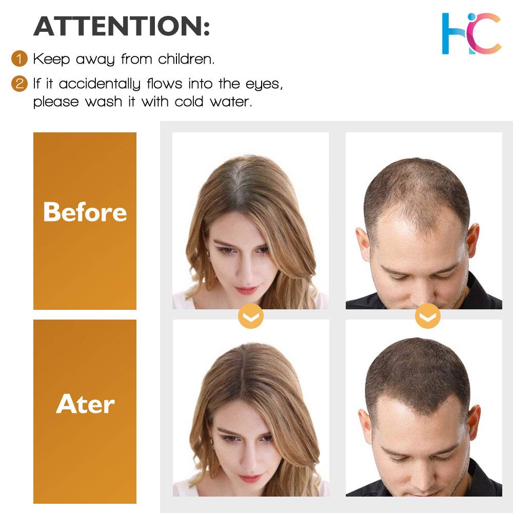 Hair Growth Serum, Ginger Hair Growth Oil, Anti Hair Loss Serum, Hair Loss Treatment for Thinning Hair, Promote Hair Growth, Strengthen Hair Roots Thickening & Regrowth Product for Women & Men (30ml) : Beauty