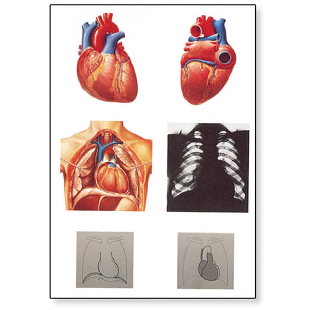 3B Scientific Human Anatomy - Heart I Chart, Anatomy