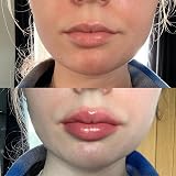 Plump It! No Needles Lip Filler Kit Original Gloss Instant Long-Term Fuller view 5