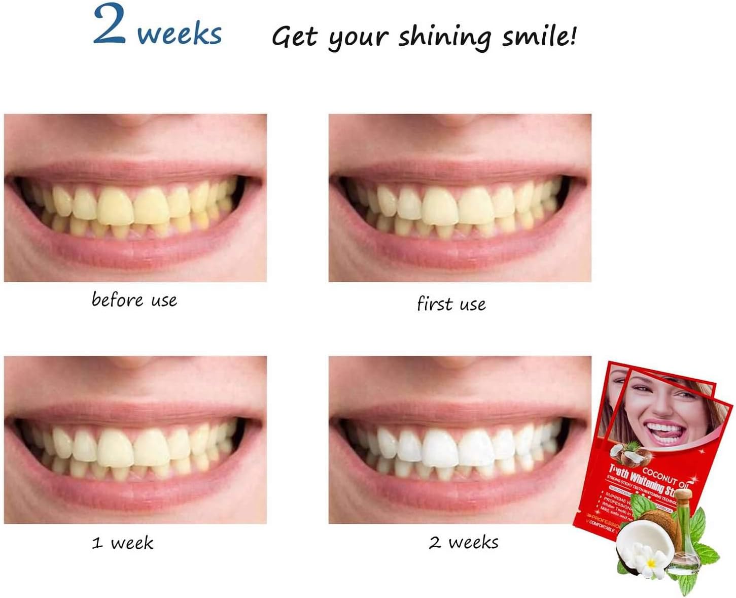 Senyum Teeth Whitening Strips 14 Treatments Dentist for Sensitive Teeth, Whitener Strips (14 for Upper 14 for Lower）: Health & Personal Care