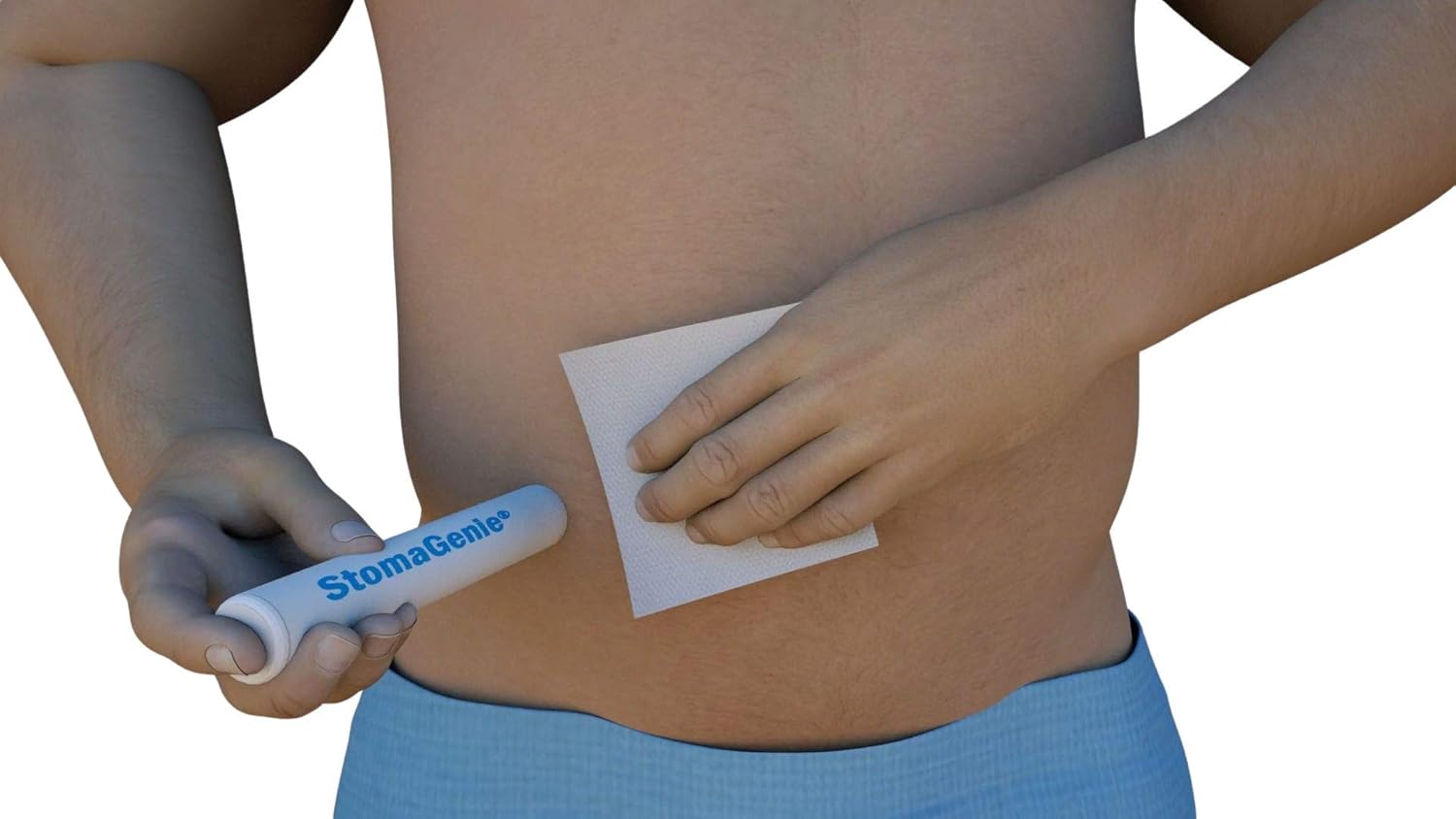 STOMAGENIE Stoma Waste Capture Device 10Pack (3/4