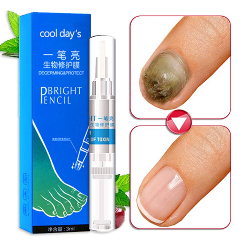 Soly Teche Nail Repair Pen, Nourishing Nails, Restores Discolored and Damaged Nails, Fungus Toenail and Nail Care Solution : Beauty