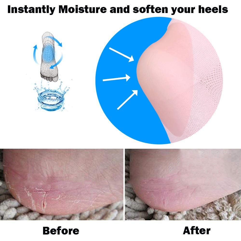 YOTURO 2 Pairs Vented Moisturizing Gel Heel Socks for Dry Hard Cracked Heels Open Toe Comfy Recovery Socks Foot Treament Day Night Care Pink and Green … : Beauty
