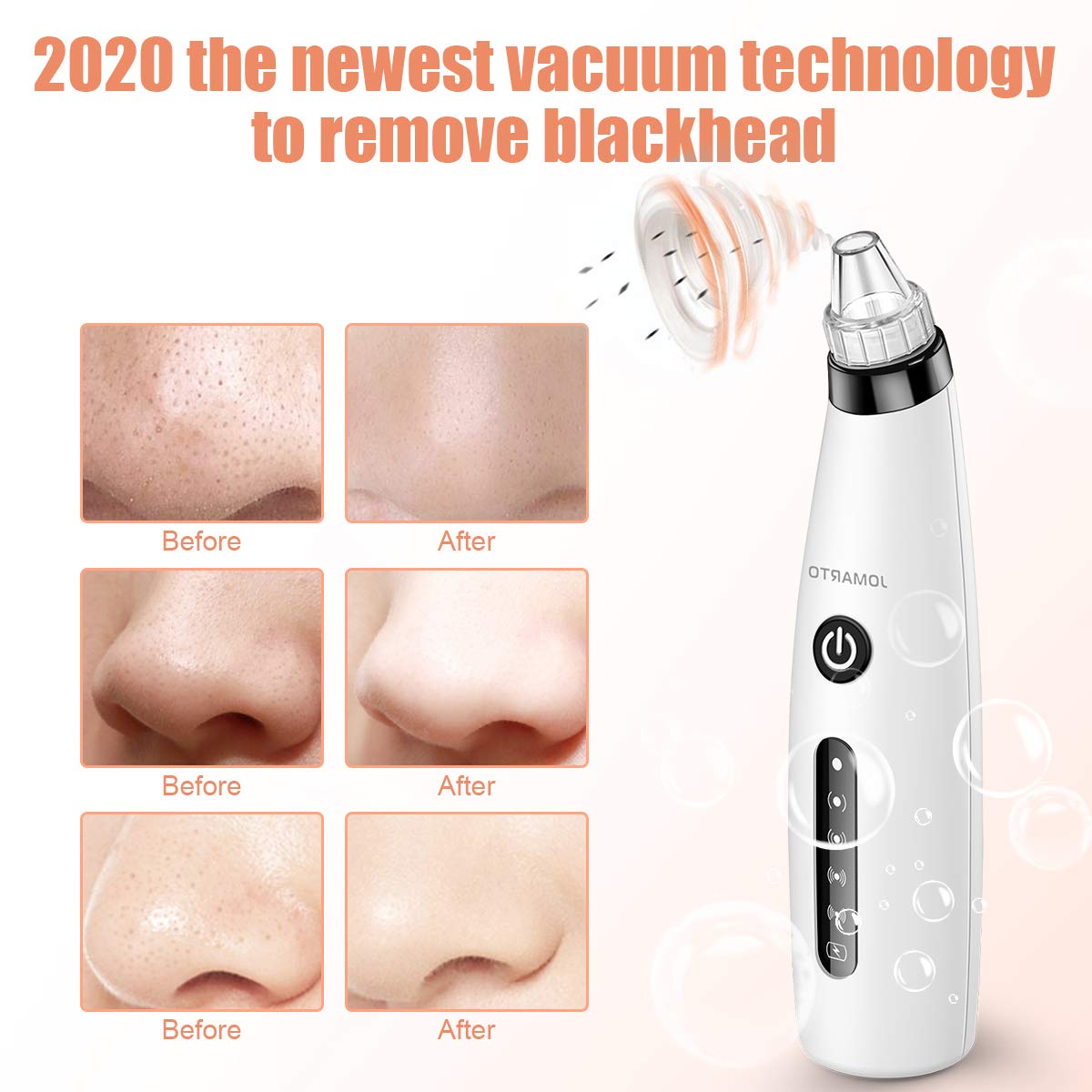Blackhead Remover Vacuum, Electric Acne Comedone Extractor, JOMARTO Skin Pore Deep Cleansing Tool with LED, 5 Adjustable Suction Power, USB Rechargeable Pore Vacuum Cleaner for Face skin (white): Beauty