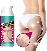Yeuxtty Butt Acne Cream Moisturizing Brightening 50ML view 2