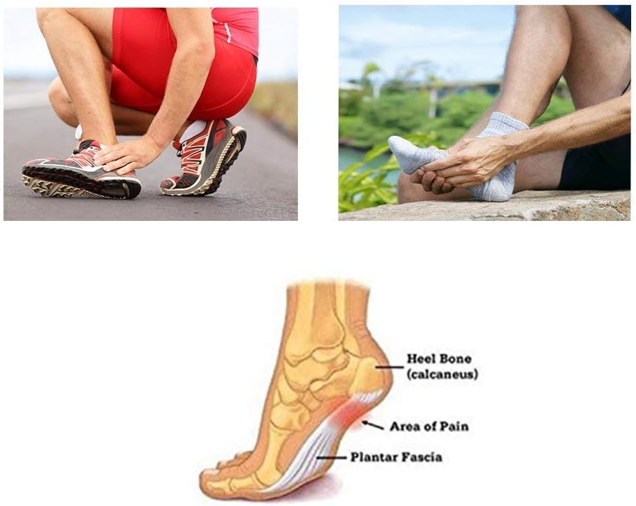Arch Support Compression Plantar Fasciitis Extra Thick Cushioned Arch Support Sleeves for Men and Women by JERN - Flat Feet Pain Relief, Achy Foot Support Insoles, Fallen Arches, Heel Spur (1 Pair): Health & Personal Care