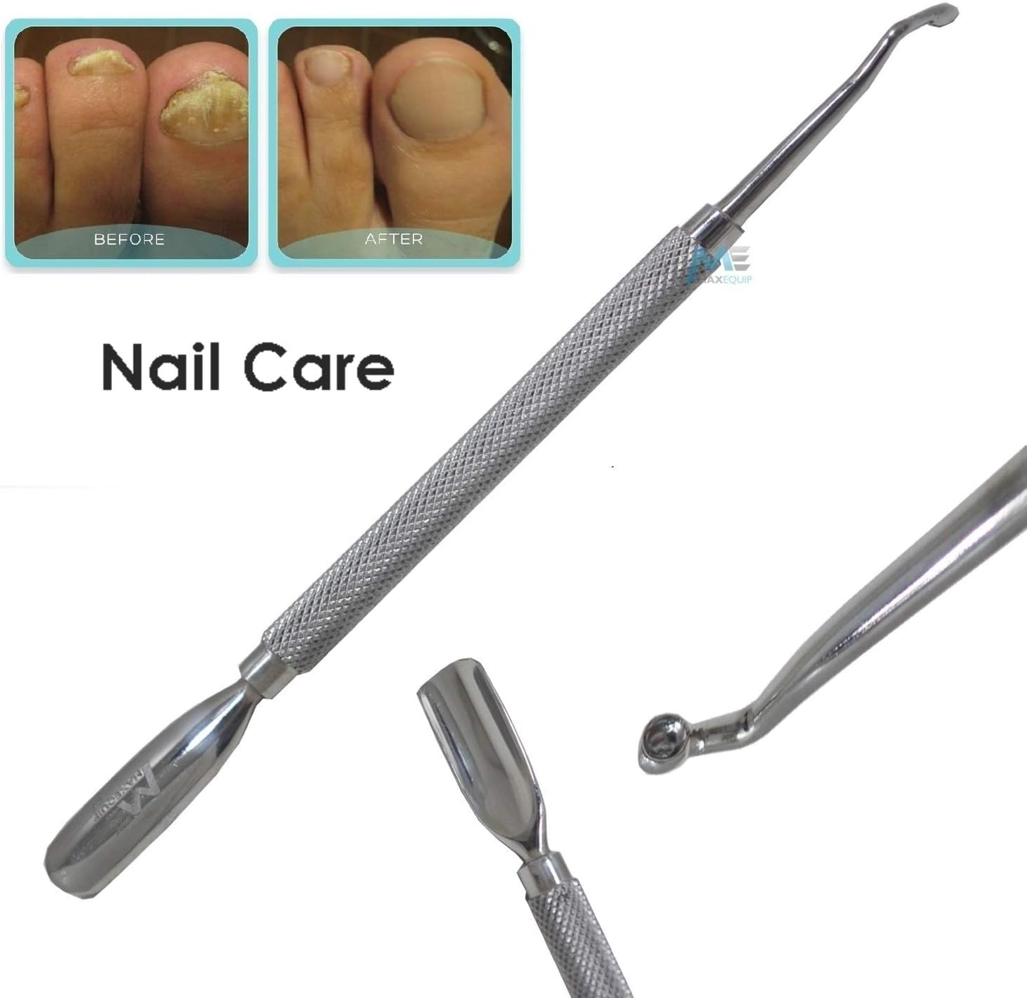 Nail Curette Nail Cleaner Scraper Tool Dual Spoon Cuticle Pusher