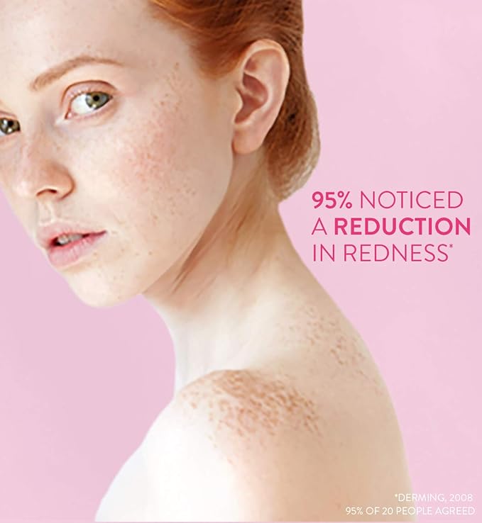 e45 rosacea