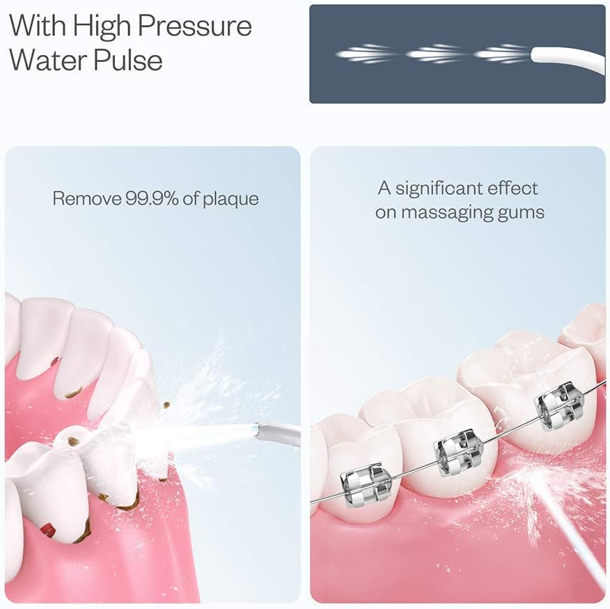 Water Flosser Cordless for Teeth, Anjou 300ML Professional Dental Oral Irrigator, Portable and Rechargeable IPX7 Waterproof Powerful Battery Life Teeth Cleaner for Home Travel, Braces and Bridges Care: Health & Personal Care