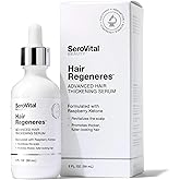 Serovital Advanced Hair Thickening Serum – Revitalize Scalp – Hair Loss Treatment – Scalp Serum Drops – Strengthen Hair- 2 Fl
