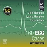 160 ECG Cases