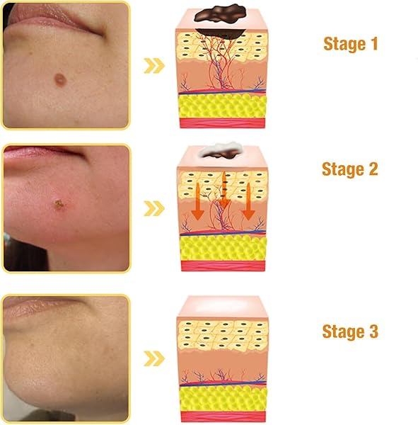 OKNIAO NEW BEE VENOM REPAIR CREAM,HYDRATING MOISTURIZING CREAM,PROFESSIONAL BEE VENOM MOISTURIZING CREAM,PROFESSIONAL BEE VENOM CREAM PROVIDES FOR ALL PARTS OF THE BODY, ALL SKIN (3PCS)