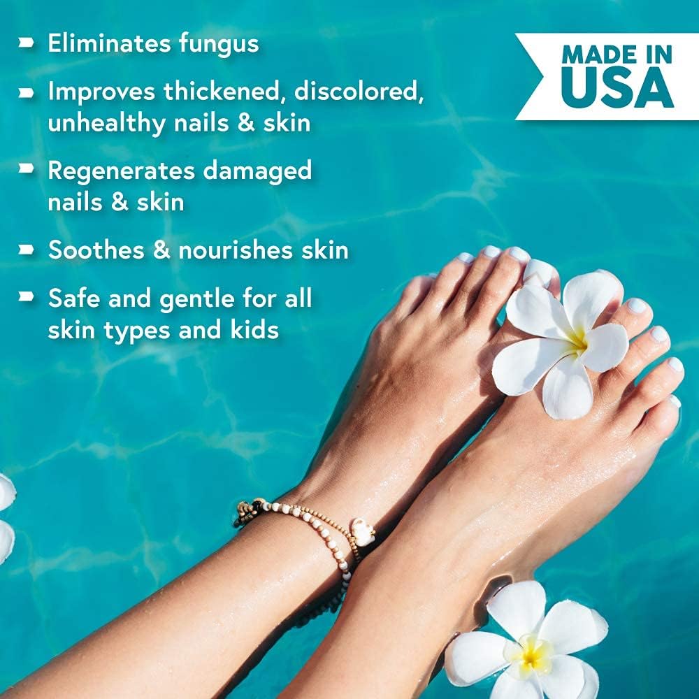 Ebanel Antifungal Treatment, 1 Oz Athletes Foot Treatment with Miconazole, Undecylenic Acid, Urea, Oregano Oil, Salicylic Acid, Kills Fungus on Skin that Leads to Nail Fungus, Ringworm Jock Itch Cream: Health & Personal Care