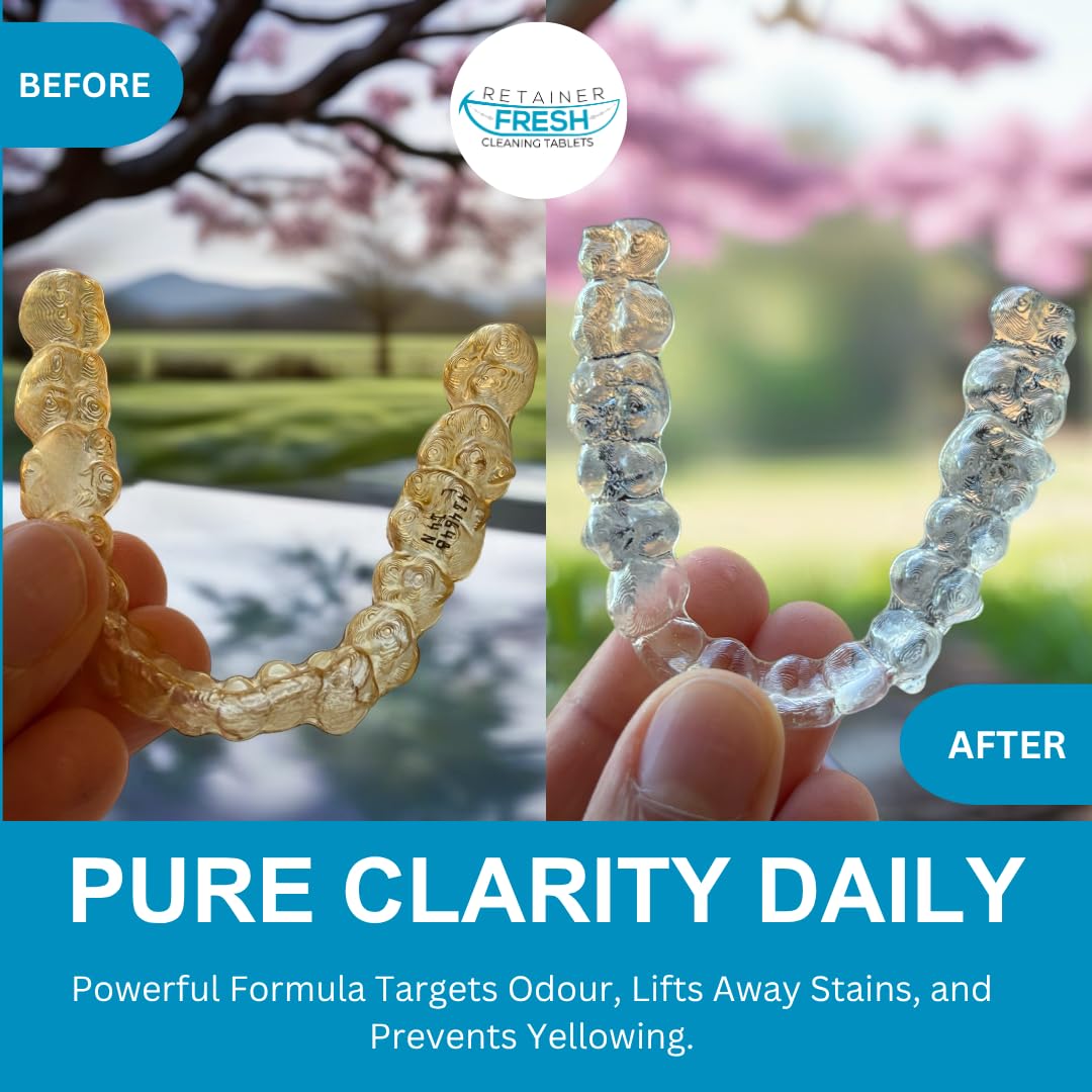 Retainer Cleaner Tablets - 120 Tablets 4 Month Retainer Fresh - Retainer Cleaning Tablets, Mouth Guard Cleaner, Denture Cleaner, Aligner Cleaner, Brite Retainer Tablets